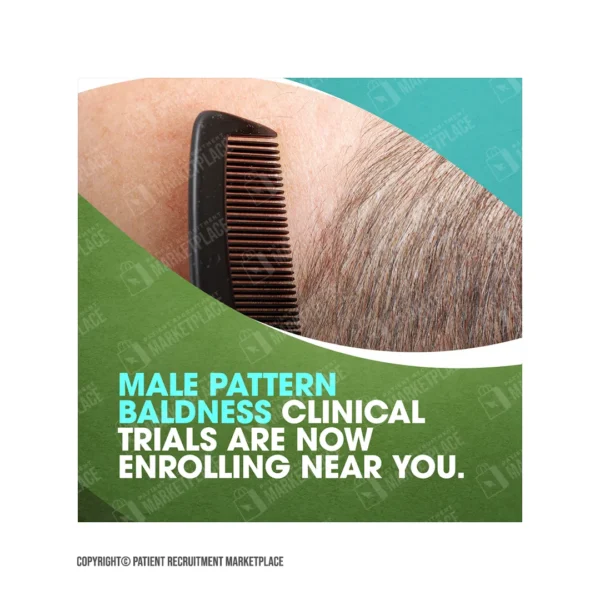 Male Pattern Baldness Study packet